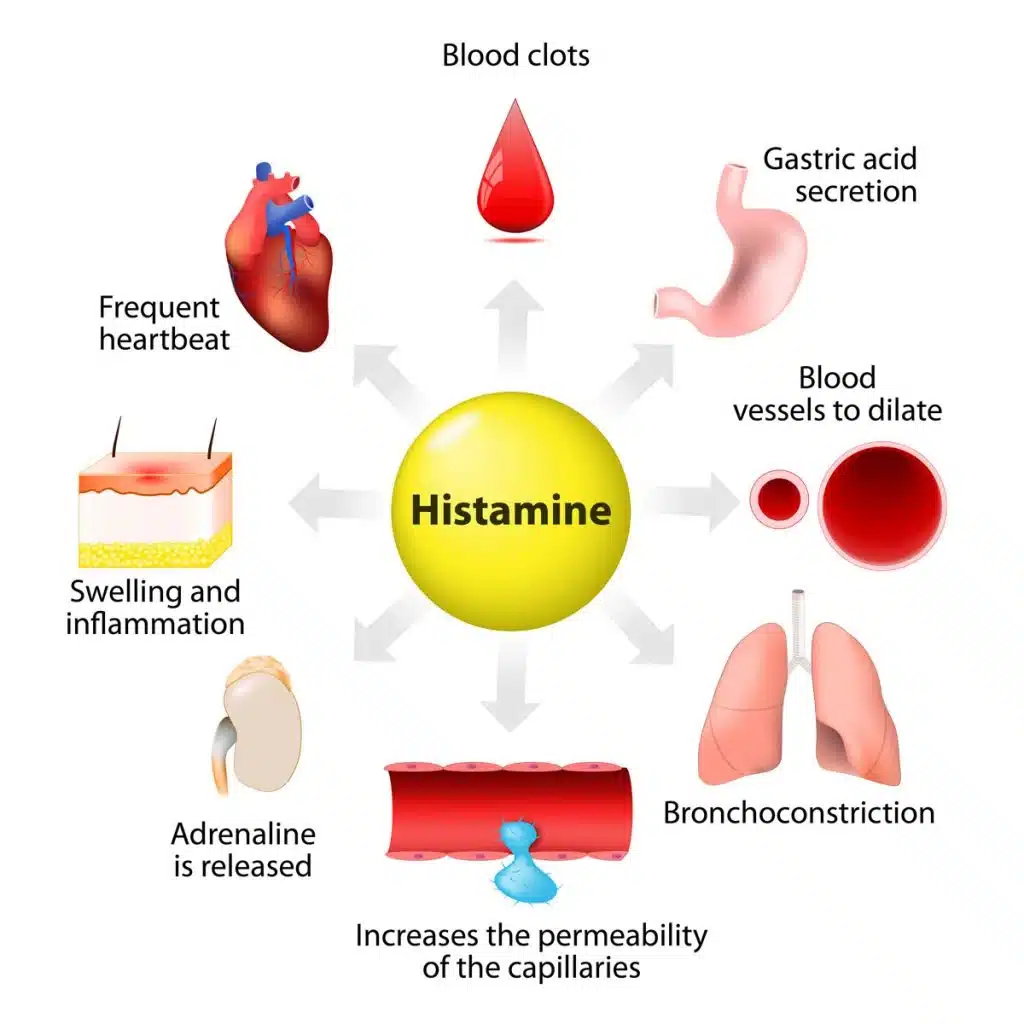 Histamine Overload in Kids: The Hidden Cause of Hyperactivity, Anxiety, and Behavior Issues